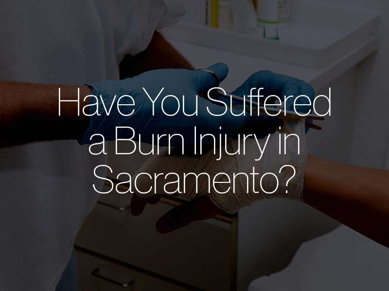 sacramento burn injury attorney