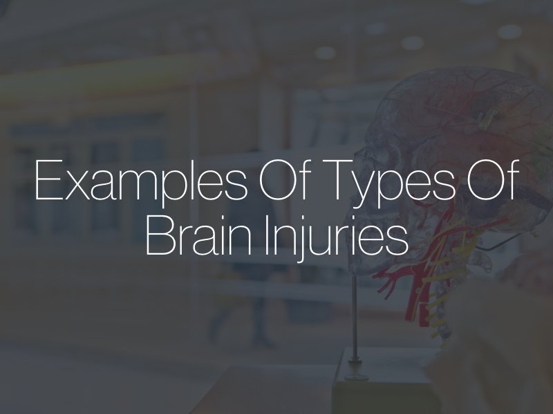 Examples Of Types of Brain Injuries